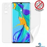 Ochranná fólie Screenshield Huawei P30 Pro - celé tělo – Zbozi.Blesk.cz