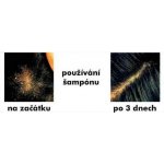 SkinCap šampon 150 ml – Zboží Dáma