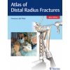 Kniha Atlas of Distal Radius Fractures