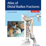 Atlas of Distal Radius Fractures – Hledejceny.cz