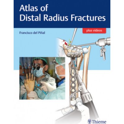 Atlas of Distal Radius Fractures – Hledejceny.cz