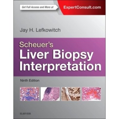 Scheuer's Liver Biopsy Interpretation - Lefkowitch, Jay H