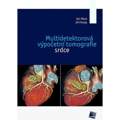 Multidetektorová výpočetní tomografie srdce - Jan Baxa, Jiří Ferda