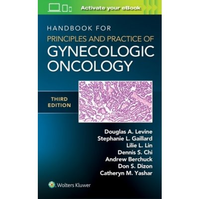 Handbook for Principles and Practice of Gynecologic Oncology – Zbozi.Blesk.cz