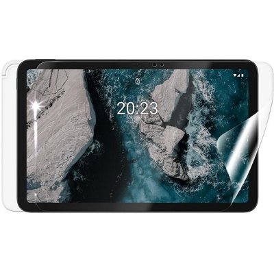 Screenshield Nokia T20 na celé tělo NOK-T20-B – Hledejceny.cz