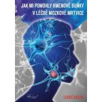 Jak mi pomohly kmenové buňku v léčbě mozkové mrtvice - Luboš Kulha – Hledejceny.cz
