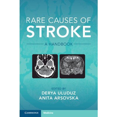Rare Causes of Stroke – Hledejceny.cz