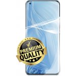 Ochranná fólie Screenshield Xiaomi Mi 11 – Sleviste.cz