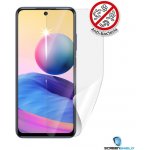 Ochranná fólie Screenshield XIAOMI Redmi Note 10 5G - displej – Hledejceny.cz