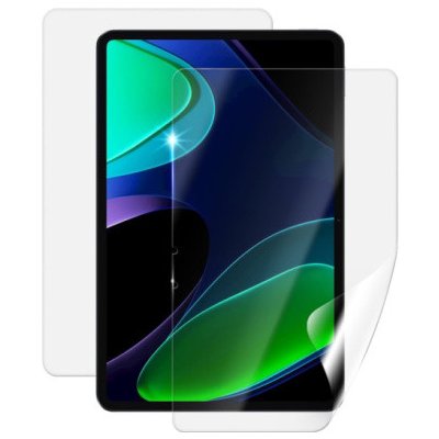 Screenshield XIAOMI Pad 6 fólie na celé tělo XIA-P6-B – Zboží Živě