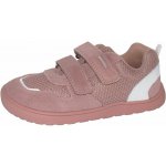 Protetika Alex nude – Zbozi.Blesk.cz