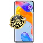 Ochranná fólie Hydrogel Xiaomi Redmi Note 11S 5G – Hledejceny.cz