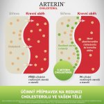 Arterin Cholesterol 30 tablet – Zbozi.Blesk.cz