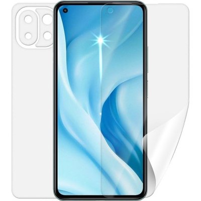 Ochranná fólie Screenshield XIAOMI 11 Lite 5G NE - celé tělo – Zbozi.Blesk.cz