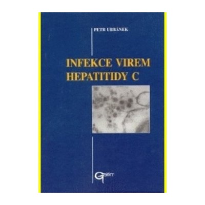 Infekce virem hepatitidy C
