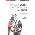 Atopický ekzém a potravinové alergie očima mámy - Jana Ligurská – Hledejceny.cz