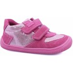 Protetika Melania Fuxia – Sleviste.cz