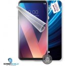 Ochranná fólie ScreenShield LG H930 V30 - displej