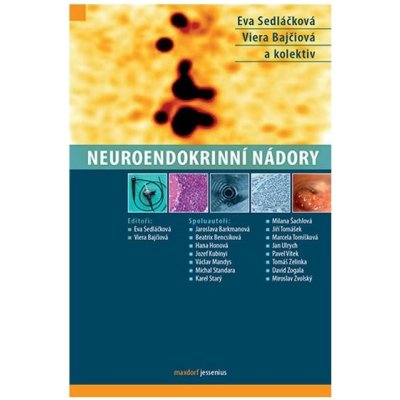 Neuroendokrinní nádory – Zbozi.Blesk.cz