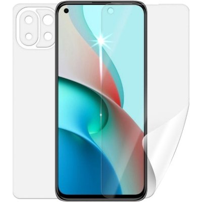 Ochranná fólie Screenshield XIAOMI Mi 11 Lite 5G - celé tělo – Zbozi.Blesk.cz