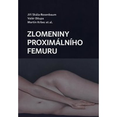 Zlomeniny proximálního femuru - Krbec Martin, Skála-Rosenbaum Jiří, Džupa Valér – Zbozi.Blesk.cz