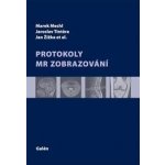 Protokoly v MR zobrazování - Jaroslav Tintěra, Marek Mechl, Jan Žižka – Hledejceny.cz