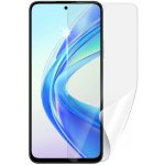 Ochranná fólie Screenshield Huawei Honor X7b - displej – Sleviste.cz