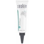 Soskin Stop Imperfection Serum 30 ml – Zboží Mobilmania