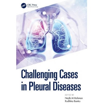 Challenging Cases in Pleural Diseases – Zboží Mobilmania