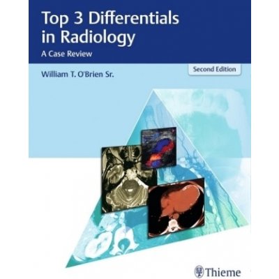 Top 3 Differentials in Radiology: A Case Review O'Brien William T.Pevná vazba – Hledejceny.cz