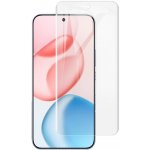 Ochranná folie IMAK HYDROGEL pro Honor 400 5G – Zboží Živě