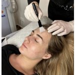 Online kurz Dr.Nek chemický peeling – Hledejceny.cz
