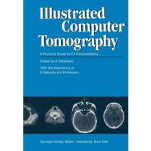 Illustrated Computer Tomography