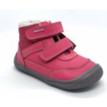 Protetika Tyrel Koral – Zboží Dáma