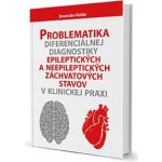 Problematika diferenciálnej diagnostiky epileptických a neepileptických záchvatových stavov v klinickej praxi - Branislav Kollár – Hledejceny.cz