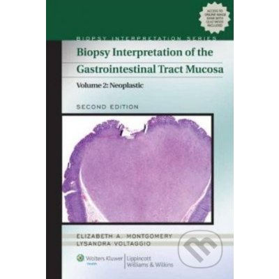 Biopsy Interpretation E. Montgomery, L. Voltaggio – Hledejceny.cz
