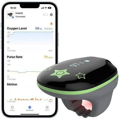 Viatom KidsO2 – Dětský monitor kyslíku – Zboží Mobilmania