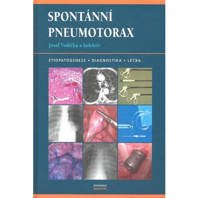 Spontánní pneumotorax - Josef Vodička – Hledejceny.cz