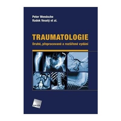 Traumatologie - Peter Wendsche