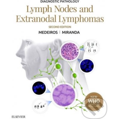Diagnostic Pathology: Lymph Nodes and Extranodal Lymphomas