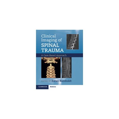 Clinical Imaging of Spinal Trauma – Hledejceny.cz