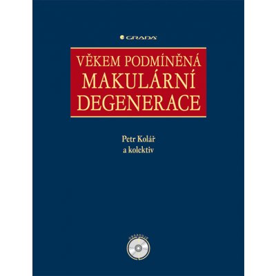 Věkem podmíněná makulární degenerace - Kolář Petr, kolektiv – Hledejceny.cz