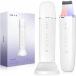 Anlan Ultrazvuková špachtle na obličej s modrým a červeným světlem – Zboží Mobilmania