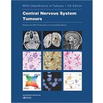 WHO Classification of Tumours: Central Nervous System Tumours - World Health Organization – Hledejceny.cz