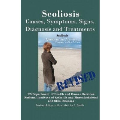 Scoliosis: Revised Edition: Causes, Symptoms, Signs, Diagnosis and Treatments – Hledejceny.cz