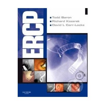 ERCP Expert Consult - Todd Baron