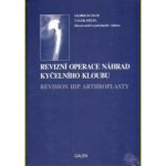 Revizní operace náhrad kyčelního kloubu – Hledejceny.cz