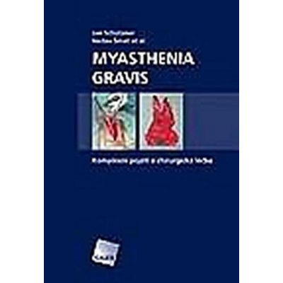 Myasthenia gravis, komplexní pojetí a chirurgická léčba
