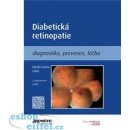 Diabetická retinopatie - Tomáš Sosna, kol.