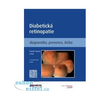 Diabetická retinopatie - Tomáš Sosna, kol.